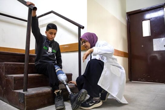 a boy with a prosthetic leg sitting on a stair case assisted by a medical person